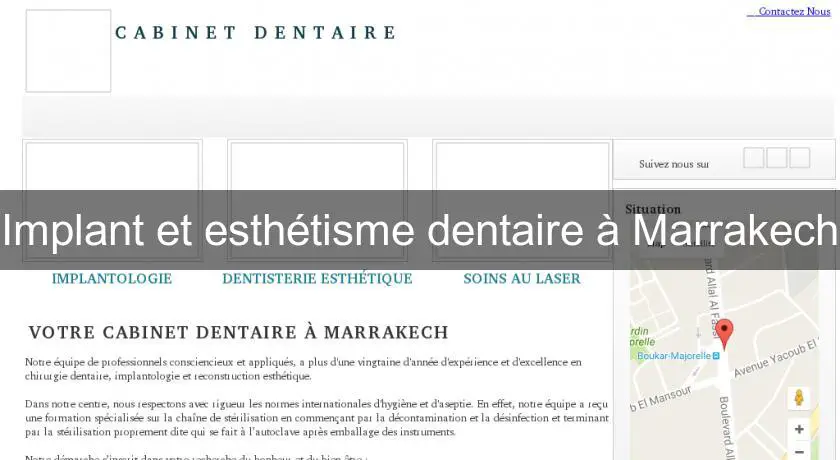 Implant et esthétisme dentaire à Marrakech