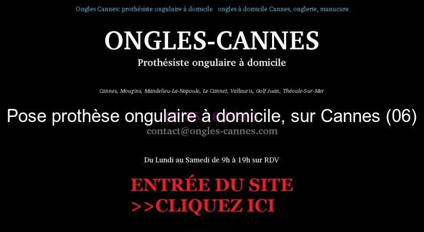 Pose prothèse ongulaire à domicile, sur Cannes (06)