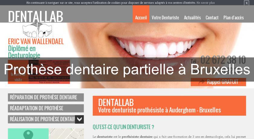 Prothèse dentaire partielle à Bruxelles