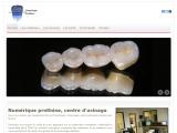 Fabrication de prothèse dentaire par usinage numérique, Montpellier (34)