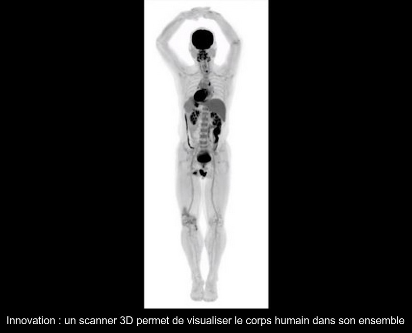 Innovation : un scanner 3D permet de visualiser le corps humain dans son ensemble