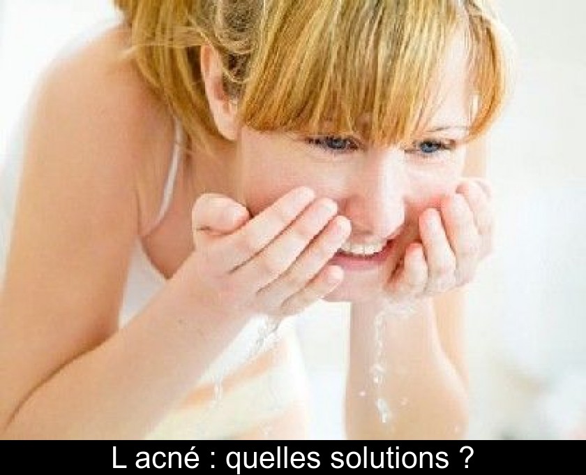 L'acné : quelles solutions ?