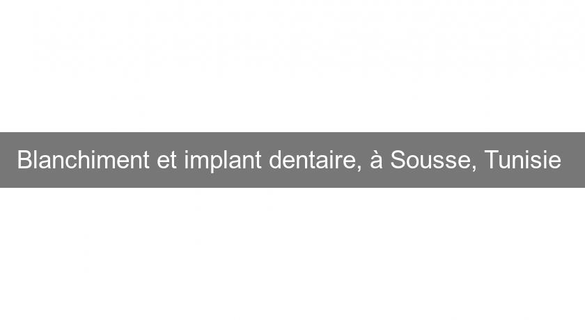 Blanchiment et implant dentaire, à Sousse, Tunisie Blanchiment et implant dentaire, à Sousse, Tunisie