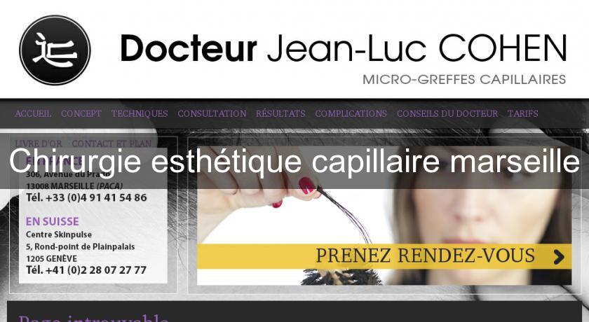 Chirurgie esthétique capillaire marseille Chirurgie esthétique capillaire marseille