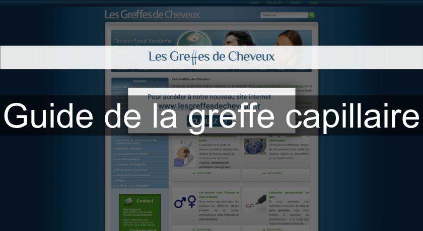 Guide de la greffe capillaire Guide de la greffe capillaire