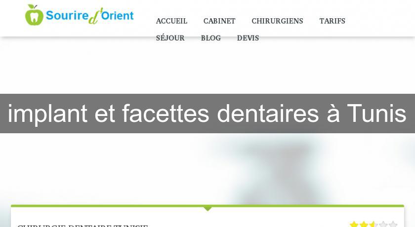 implant et facettes dentaires à Tunis implant et facettes dentaires à Tunis