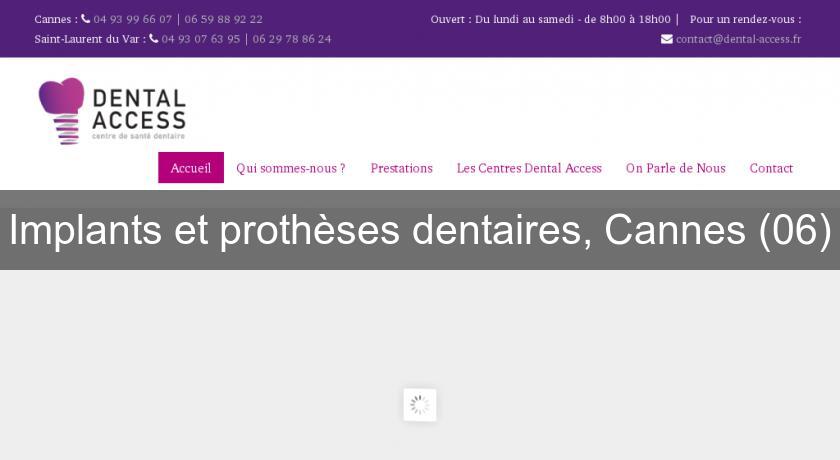Implants et prothèses dentaires, Cannes (06) Implants et prothèses dentaires, Cannes (06)