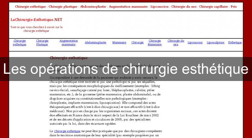 Les opérations de chirurgie esthétique Les opérations de chirurgie esthétique