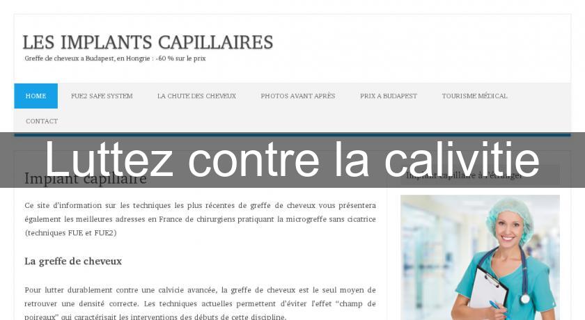 Luttez contre la calivitie Luttez contre la calivitie