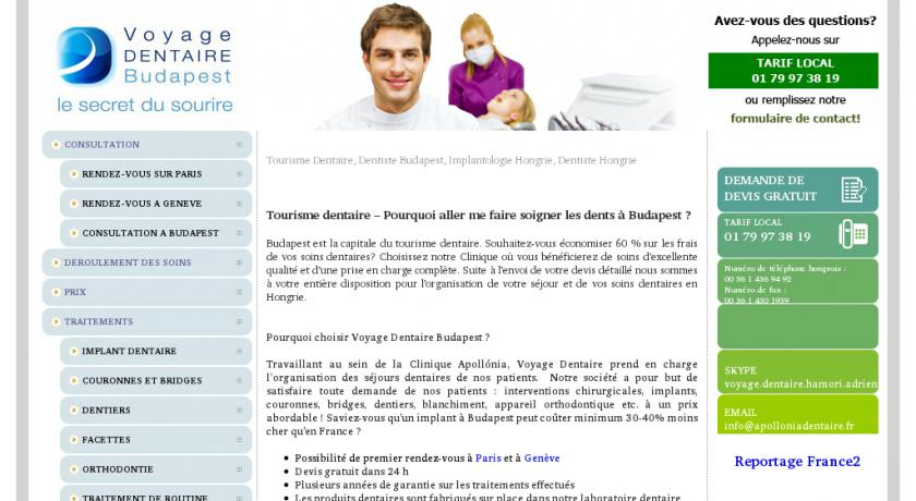 Soins d'esthétisme dentaire à Budapest Soins d'esthétisme dentaire à Budapest
