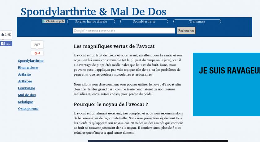 Symptômes et traitement de la spondylarthrite ankylosante Symptômes et traitement de la spondylarthrite ankylosante