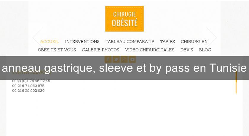 anneau gastrique, sleeve et by pass en Tunisie anneau gastrique, sleeve et by pass en Tunisie