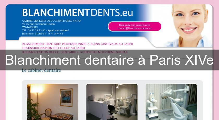 Blanchiment dentaire à Paris XIVe Blanchiment dentaire à Paris XIVe