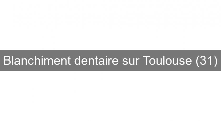 Blanchiment dentaire sur Toulouse (31)