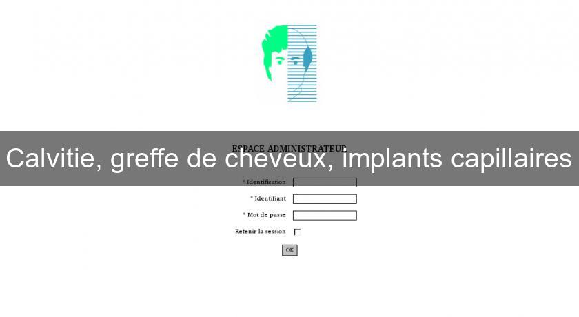 Calvitie, greffe de cheveux, implants capillaires Calvitie, greffe de cheveux, implants capillaires