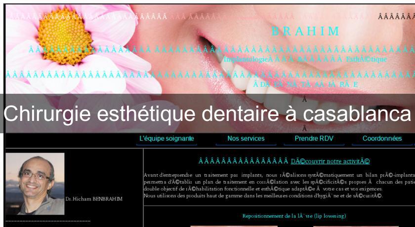 Chirurgie esthétique dentaire à casablanca