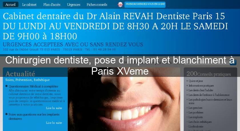 rendez vous dentiste paris rendez vous dentiste paris