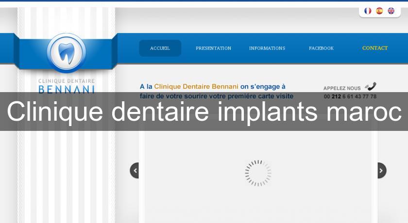 Clinique dentaire implants maroc