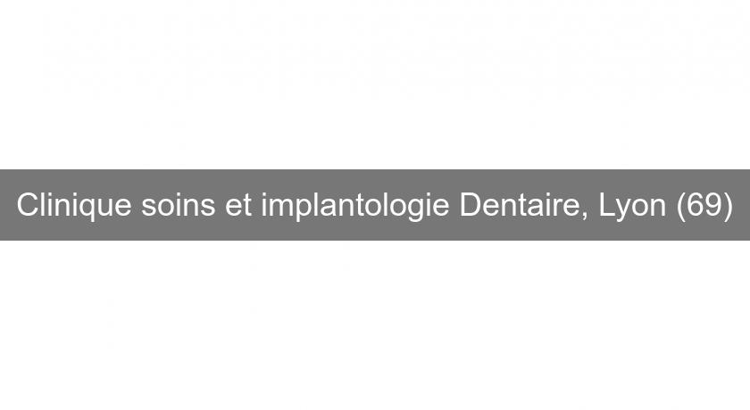 Clinique soins et implantologie Dentaire, Lyon (69) Clinique soins et implantologie Dentaire, Lyon (69)