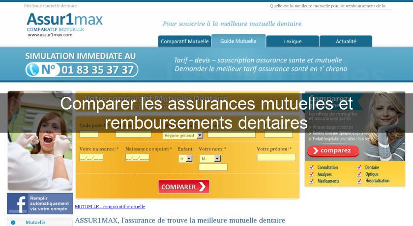 Comparer les assurances mutuelles et remboursements dentaires Comparer les assurances mutuelles et remboursements dentaires
