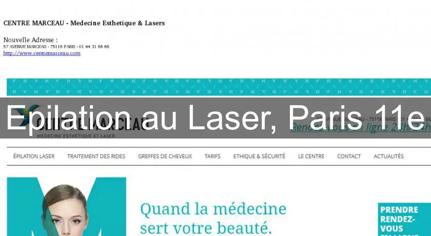 Epilation au Laser, Paris 11e