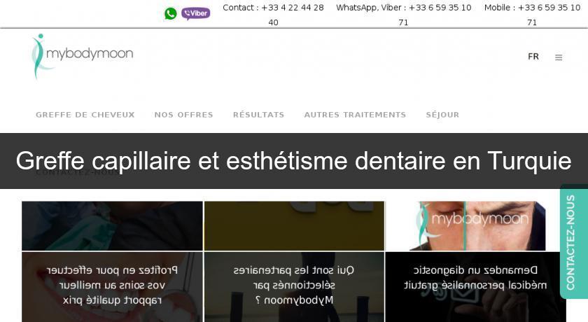 Greffe capillaire et esthétisme dentaire en Turquie Greffe capillaire et esthétisme dentaire en Turquie