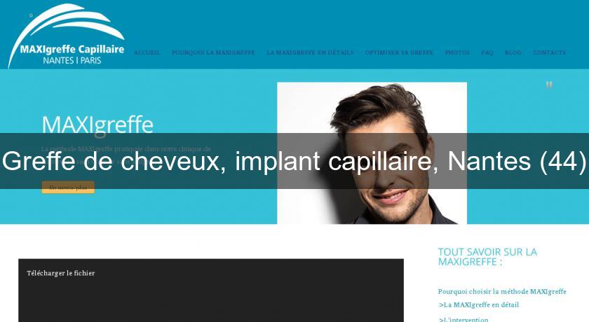 Greffe de cheveux, implant capillaire, Nantes (44)