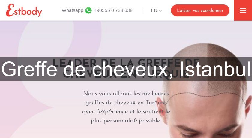 Greffe de cheveux, Istanbul Greffe de cheveux, Istanbul