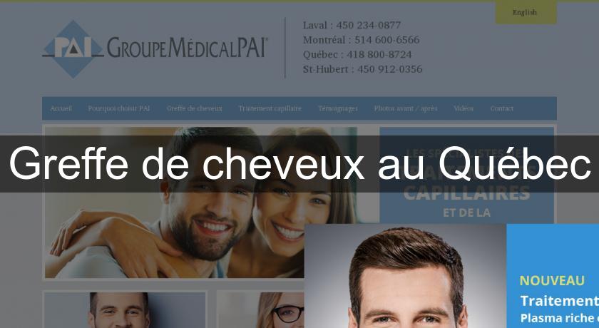 Greffe de cheveux au Québec