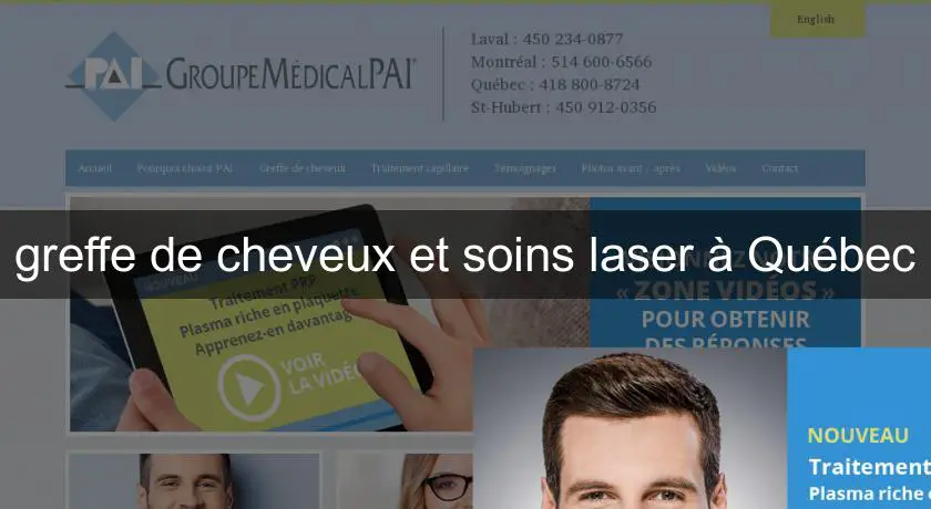 greffe de cheveux et soins laser à Québec