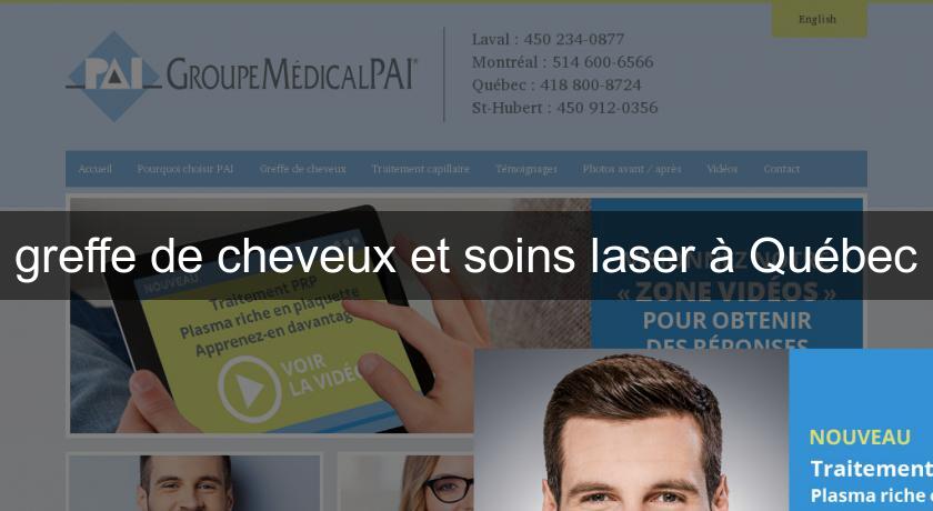 greffe de cheveux et soins laser à Québec greffe de cheveux et soins laser à Québec