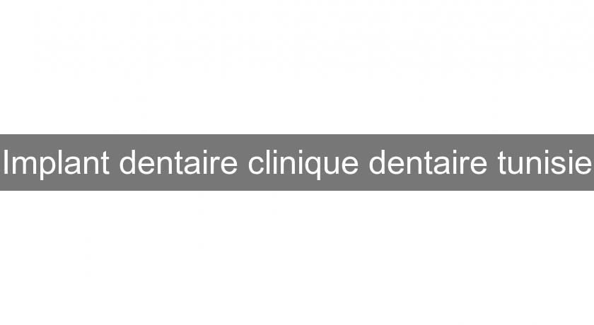 Implant dentaire clinique dentaire tunisie Implant dentaire clinique dentaire tunisie