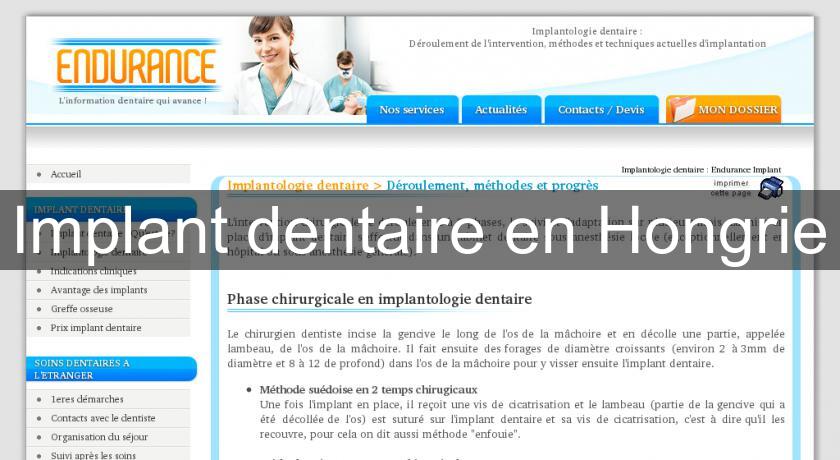 Implant dentaire en Hongrie Implant dentaire en Hongrie