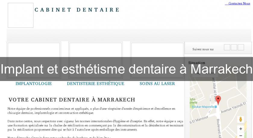 Implant et esthétisme dentaire à Marrakech Implant et esthétisme dentaire à Marrakech