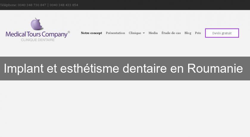 Implant et esthétisme dentaire en Roumanie Implant et esthétisme dentaire en Roumanie