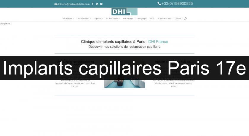 Implants capillaires Paris 17e