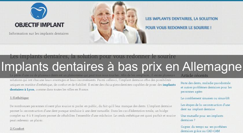 Implants dentaires à bas prix en Allemagne Implants dentaires à bas prix en Allemagne