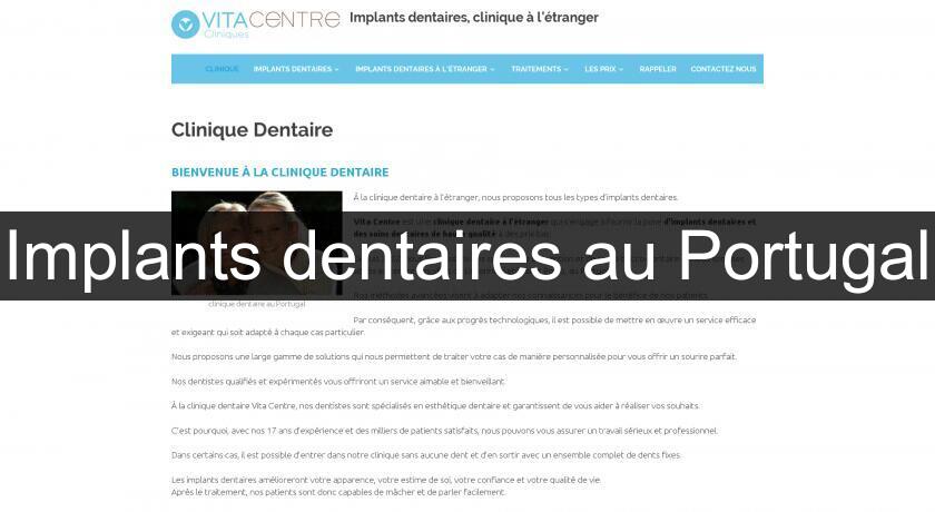 Implants dentaires au Portugal Implants dentaires au Portugal
