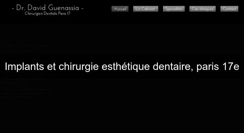 Implants et chirurgie esthétique dentaire, paris 17e