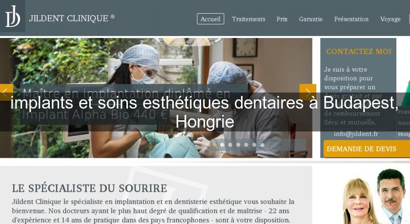 implants et soins esthétiques dentaires à Budapest, Hongrie implants et soins esthétiques dentaires à Budapest, Hongrie