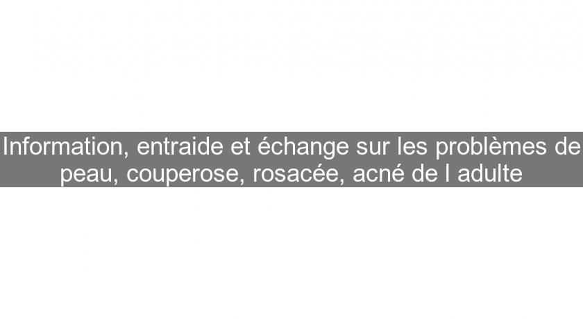 Information, entraide et échange sur les problèmes de peau, couperose, rosacée, acné de l'adulte Information, entraide et échange sur les problèmes de peau, couperose, rosacée, acné de l'adulte