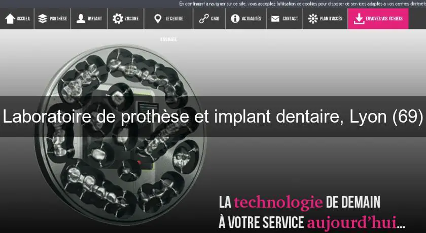 Laboratoire de prothèse et implant dentaire, Lyon (69)