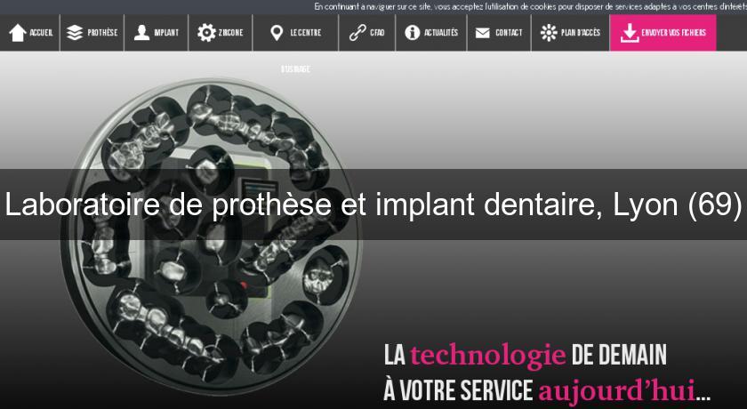 Laboratoire de prothèse et implant dentaire, Lyon (69) Laboratoire de prothèse et implant dentaire, Lyon (69)