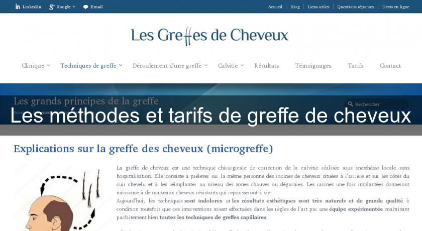 Les méthodes et tarifs de greffe de cheveux Les méthodes et tarifs de greffe de cheveux