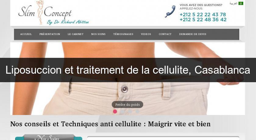 Liposuccion et traitement de la cellulite, Casablanca