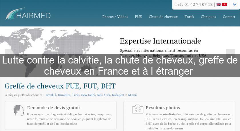 Lutte contre la calvitie, la chute de cheveux, greffe de cheveux en France et à l'étranger Lutte contre la calvitie, la chute de cheveux, greffe de cheveux en France et à l'étranger