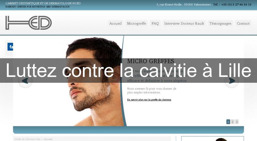 Luttez contre la calvitie à Lille Luttez contre la calvitie à Lille