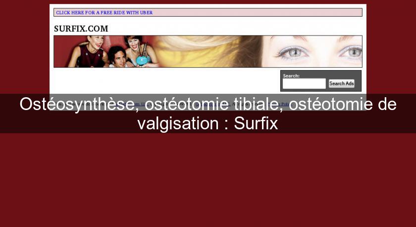 Ostéosynthèse, ostéotomie tibiale, ostéotomie de valgisation : Surfix Ostéosynthèse, ostéotomie tibiale, ostéotomie de valgisation : Surfix