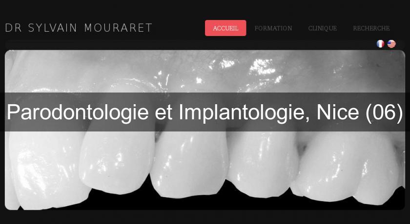 Parodontologie et Implantologie, Nice (06)