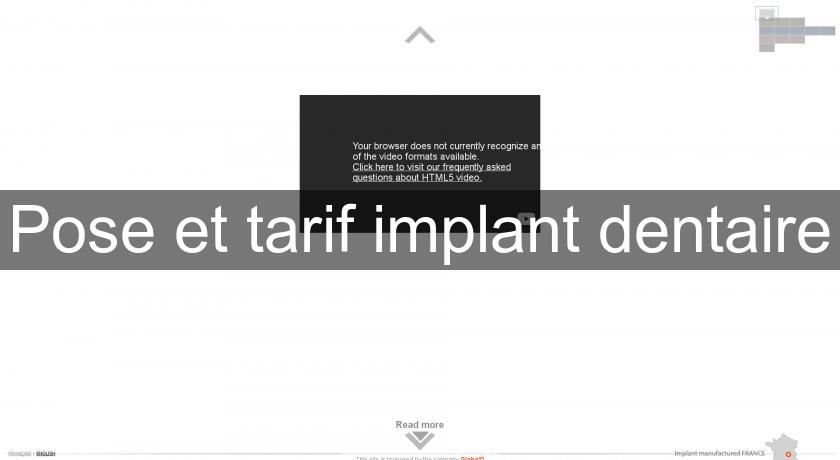 Pose et tarif implant dentaire